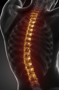 costs-spinal-injury-over-lifetime