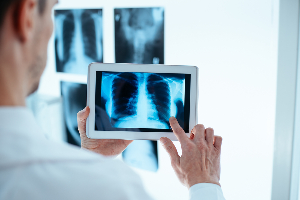 doctor examining x-ray of chest and ribs on digital tablet